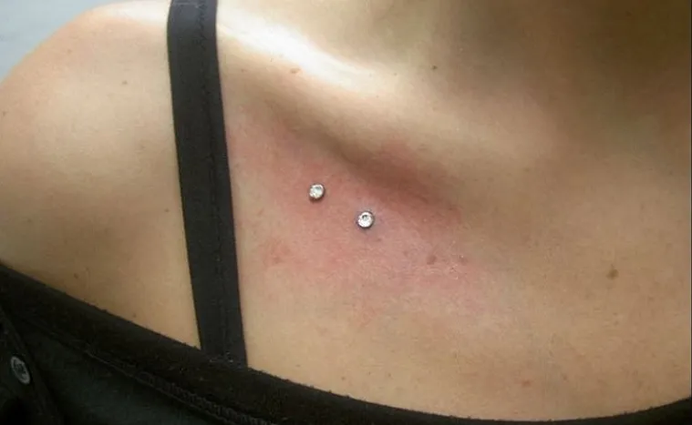 microdermal